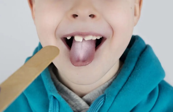 Jakie błędy najczęściej popełniamy podczas leczenia pleśniawek?