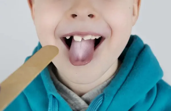 Jakie błędy najczęściej popełniamy podczas leczenia pleśniawek?